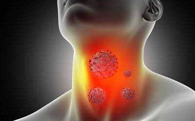 Myths About Thyroid Cancer